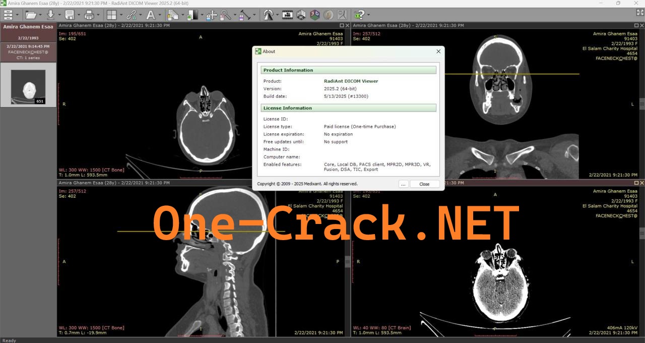 RadiAnt DICOM Viewer